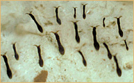 Diptera - Simuliidae